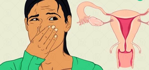 علاج رائحة المهبل الكريهة للحامل وللمتزوجة